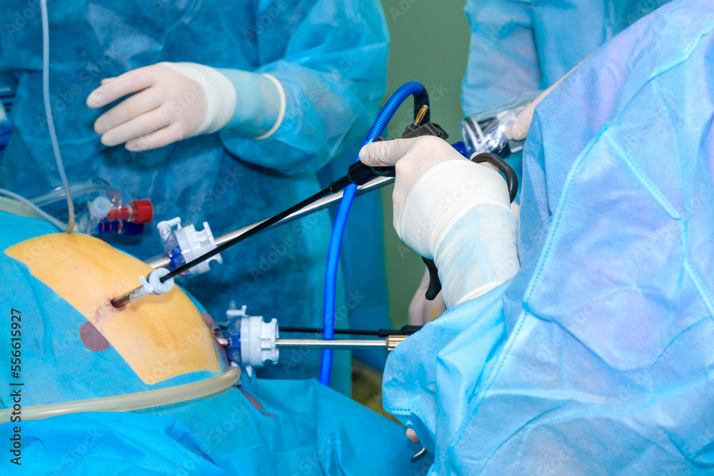 Laparoscopic Surgical Manipulators In The Hands Of Doctors During