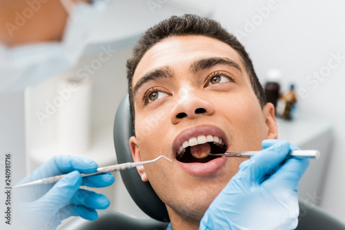  african american man with open mouth during checkup in dental clinic