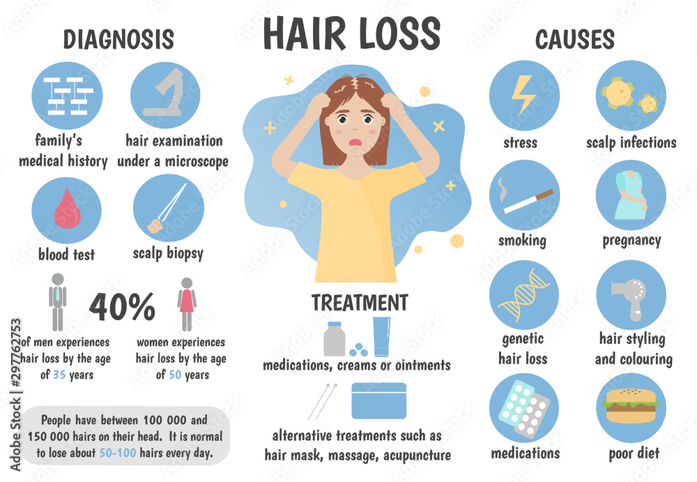 Medical Infographics Hair Loss Alopecia Baldness Causes Diagnosis