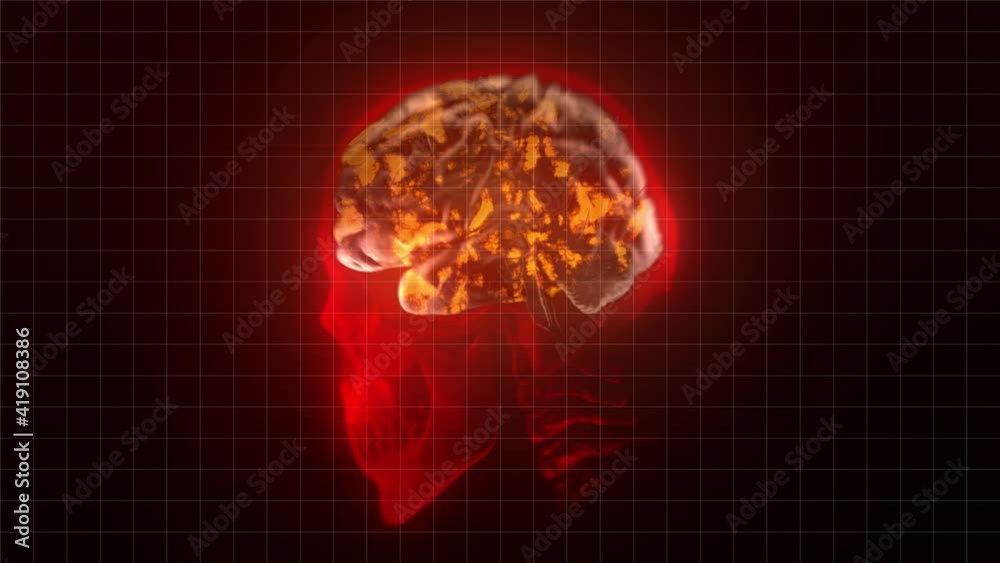 Animation Of A Human Brain Scan X Ray Visualization Of The Lateral