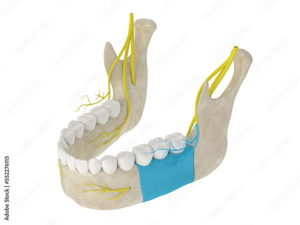 Mandibular Arch With Buccal Nerve Block Stock Illustration Adobe Stock