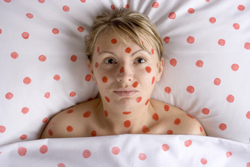 woman with red spots on face and body