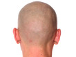 bald man