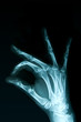Radiografia della mano