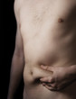 © dundanim - Male belly fat