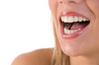 © FOTOCROMO - Closeup of beautiful young woman laughing with beautiful teeth