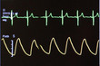 close-up electrocardiograph