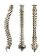 Human spine with  Disc isolated - lateral, posterior, anterio