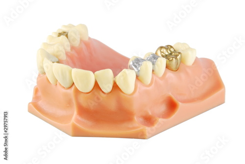 Fotografija Dental model (with different treatments)