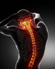 Poster - Male Body Cervical Backbone pain scan