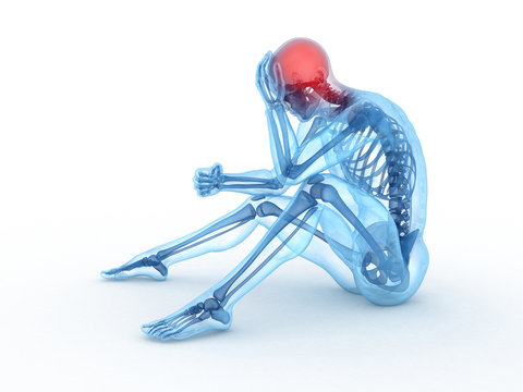 3d rendered medical illustration of a sitting male - headache