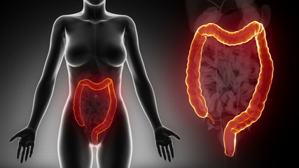 Wall Mural - Female COLON anatomy details black x-ray loop