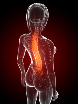 3d rendered anatomy illustration - painful back