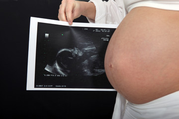 woman holding an obstetric sonogram next to her belly