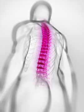 3d rendered, medical illustration of a painful spine