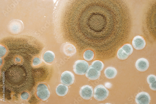Fotografie, Obraz Macro mold colonies growing on an agar plates.