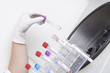 © Alexander Gospodinov - Hands loads blood samples in centrifuge