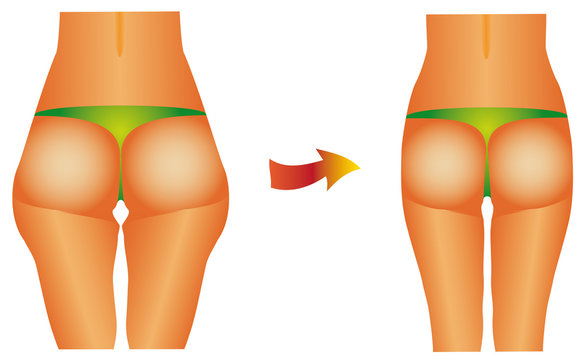 Diet beauty before after female buttocks