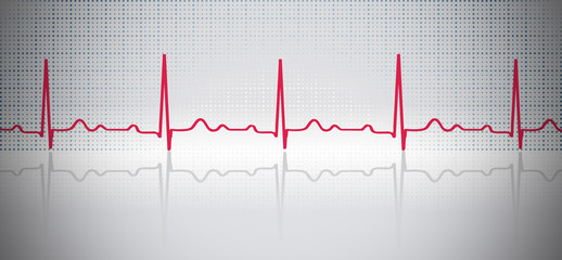 ECG background