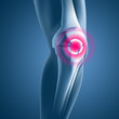 Knie-Schmerzen - 3D Grafik