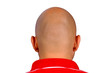 Bald head
