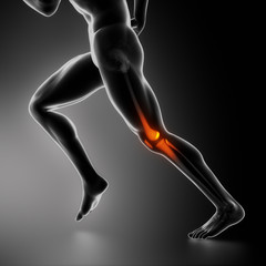 Wall Mural - Sports knee injury x-ray concept