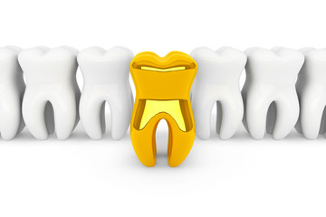 Poster - Extreme closeup gold tooth