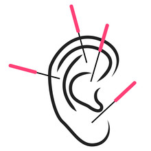 Illustration Of Ear Acupuncture