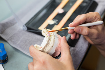 Wall Mural - Closeup of dental technician applying porcelain