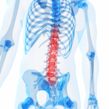 3d rendered illustration of a painful back