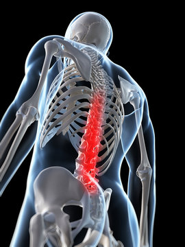 3d rendered illustration of a painful back