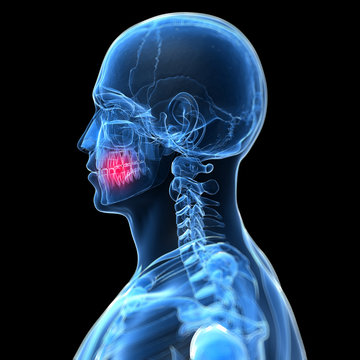 3d rendered illustration of painful teeth