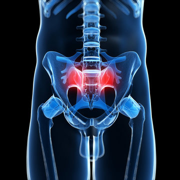 3d rendered illustration of a painful sacrum