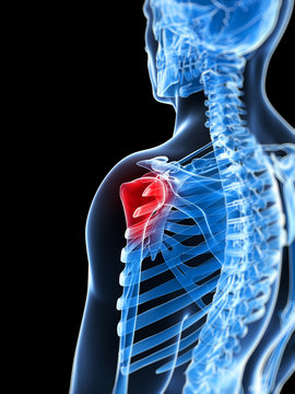 3d rendered illustration of a painful shoulder