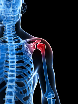 3d rendered illustration of a painful shoulder