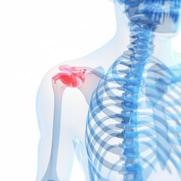 3d rendered illustration of a painful shoulder
