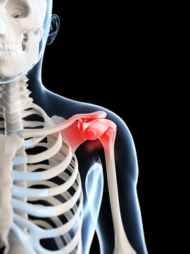 3d rendered illustration of a painful shoulder