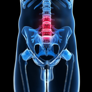 3d rendered illustration of a painful back