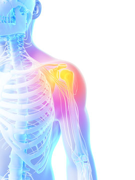 3d rendered illustration - painful shoulder