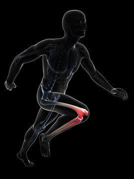 3d rendered illustration - painful runner joints