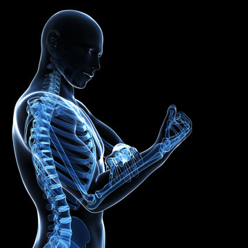 3d rendered illustration - painful arm