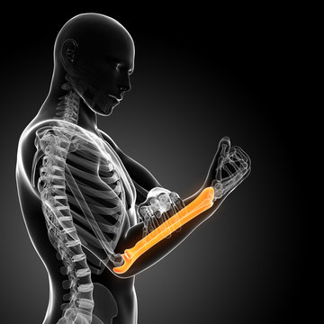 3d rendered illustration - painful arm