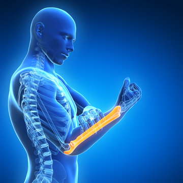 3d rendered illustration - painful arm