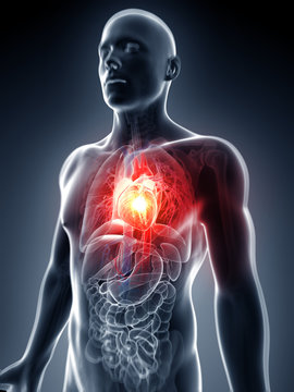 3d rendered illustration - heart attack