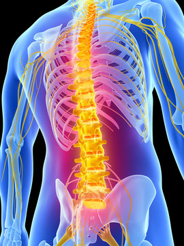 3d rendered illustration - backache