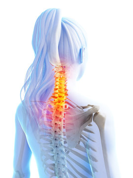 3d rendered illustration of pain in the upper spine