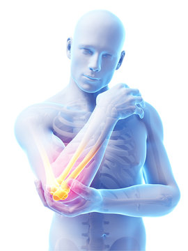 3d rendered illustration of pain in the elbow