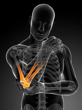 3d rendered illustration of pain in the elbow