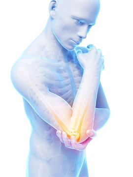 3d rendered illustration of pain in the elbow