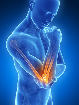 3d rendered illustration of pain in the elbow